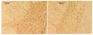 acuteMPTP-histology-MDB300px