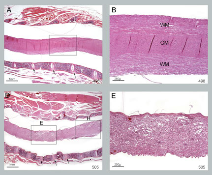 MOG-histology