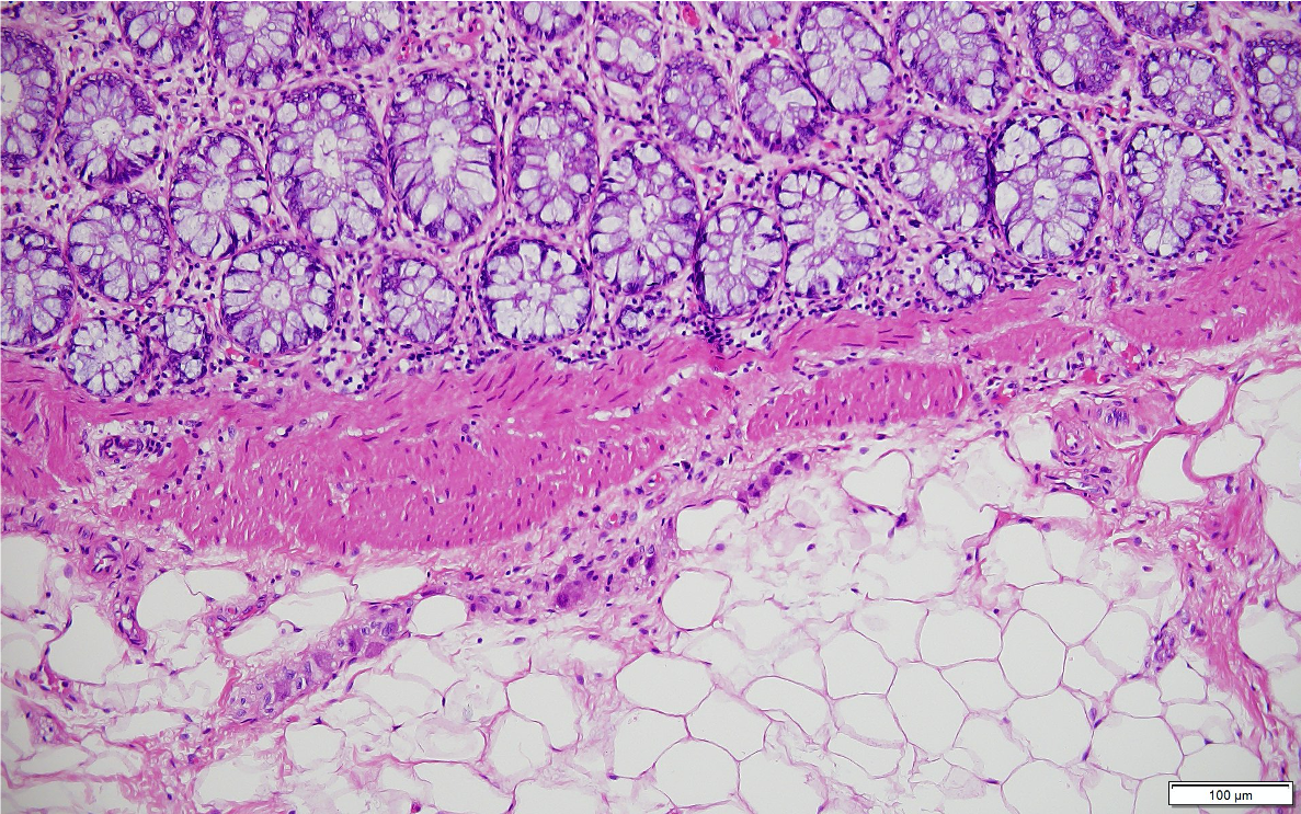 H&E_colon_MD Biosciences