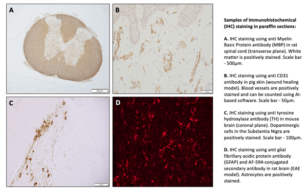 IHC-1 (1)