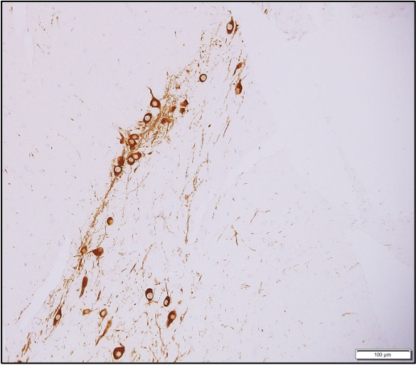 IHC_tyrosine hydroxylase antibody_MD Biosciences