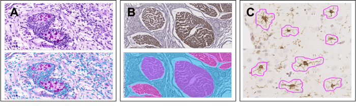 ai-analysis-histology