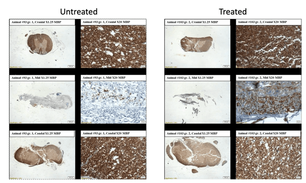 Spinal Cord Injury-1