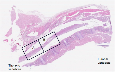 Spinal Cord injury histology