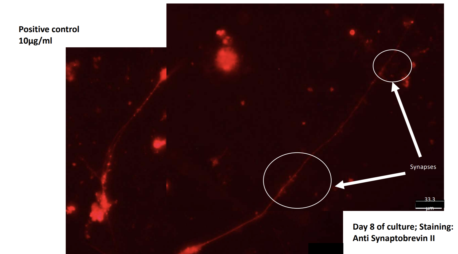 synapse formation after SCI