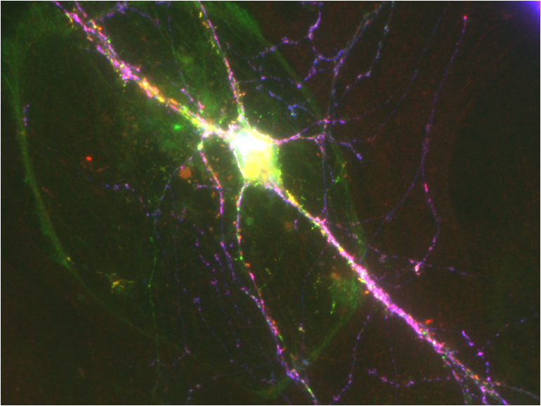 GAD65-synaptic-imaging
