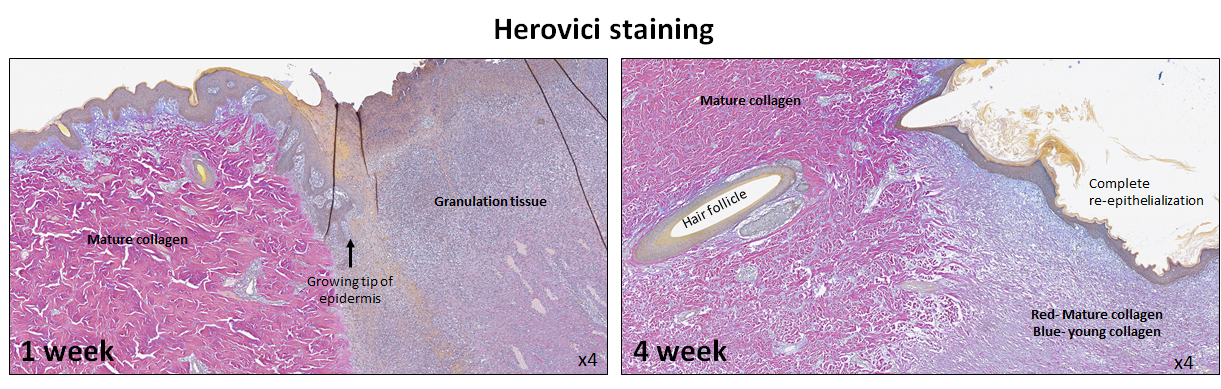 Herovici-staining-MDBiosciences