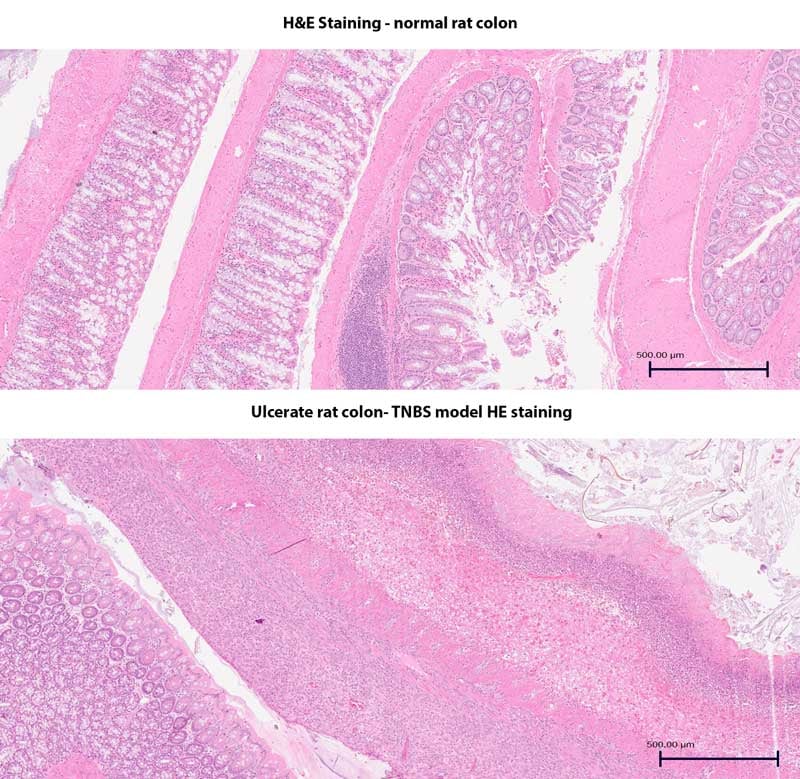 Histology-colon-TNBS-MDBisociences