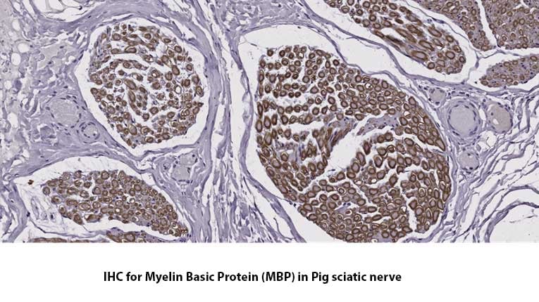 IHC-for-Myelin-Basic-Protein-MDBiosciences