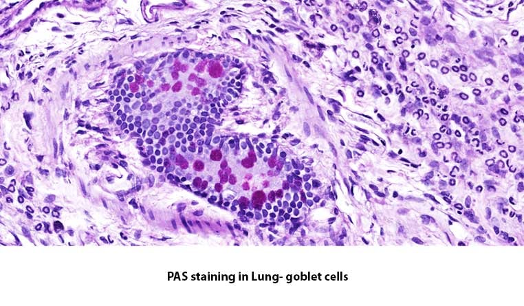 PAS-lung-histology-MDBiosciences
