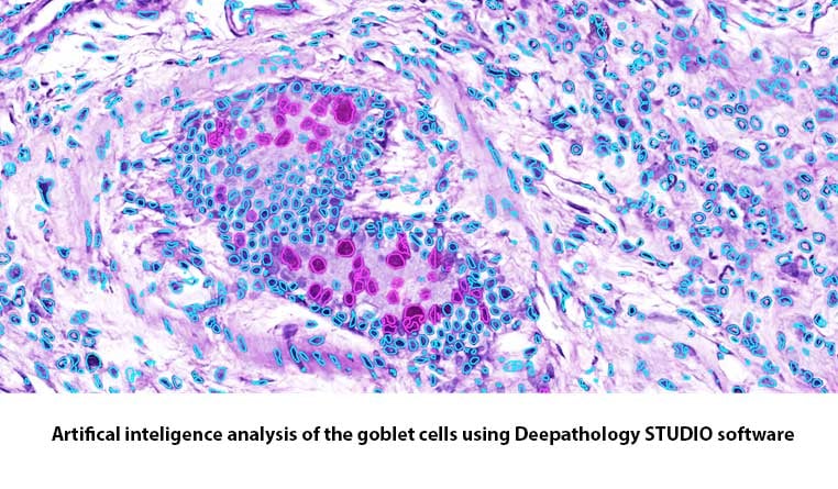 goblet-cells