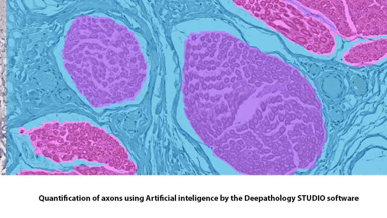 quantification-axons-histology-MDBiosciences