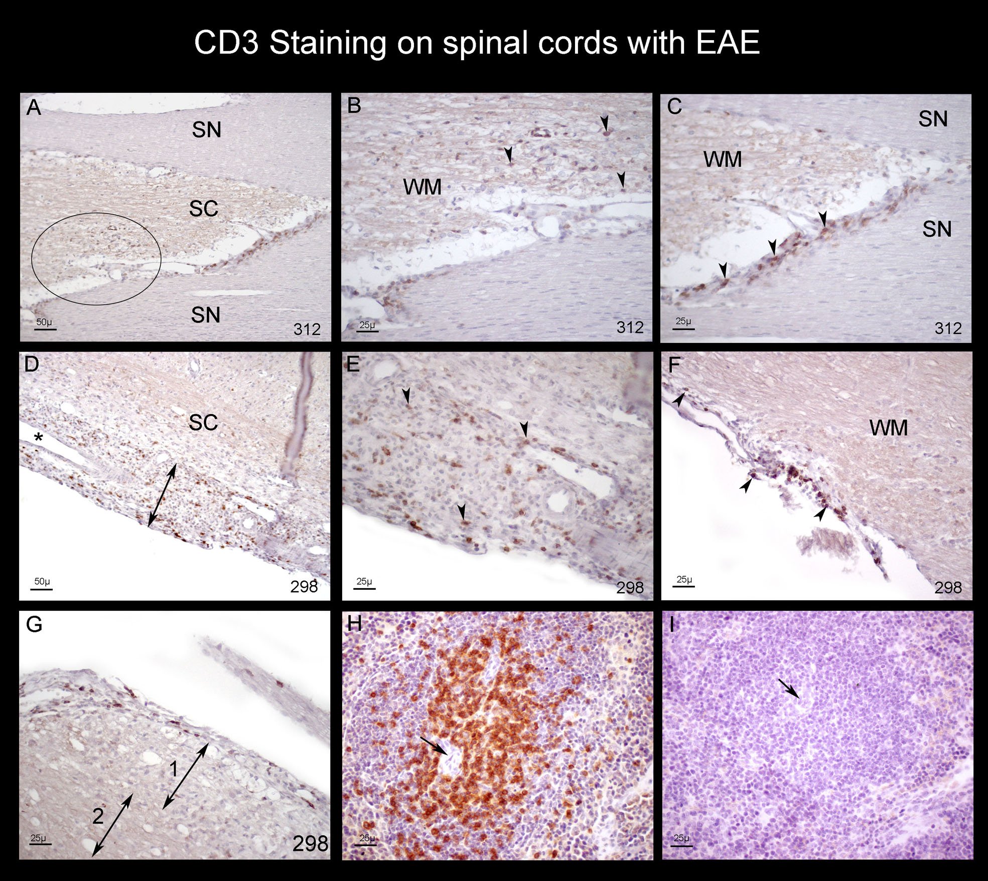 CD3 MDB LR-1