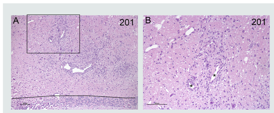 MBP-Induced-EAE-H&E-Staining-Brain-Tissue-Spinal-Cord