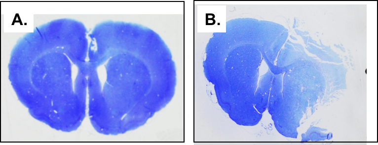 MCAo-Stroke-Model-Thionin-Staining-In-Brain-Sections