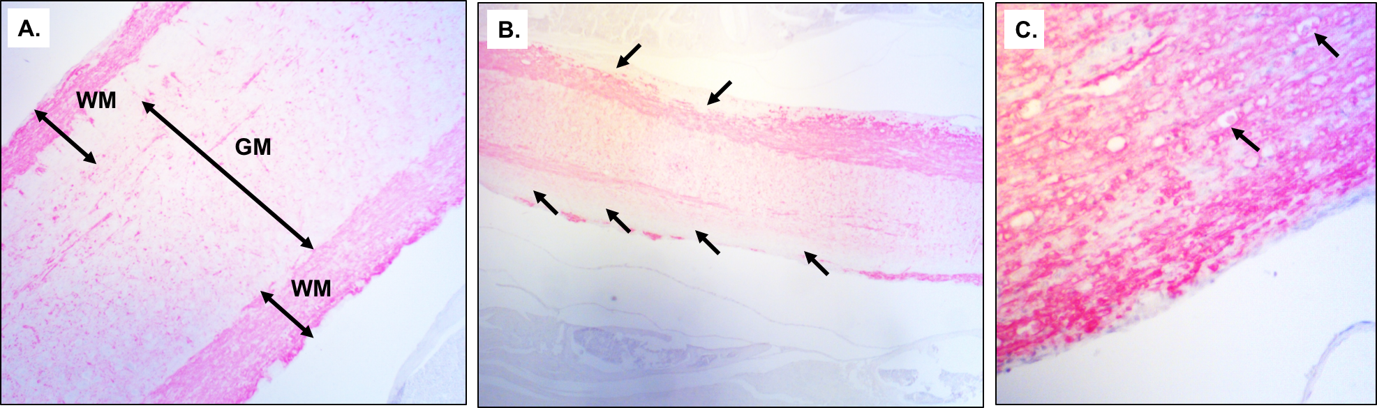 IHC-Staining-Longitudinal-Sections-of-Spinal-Cord-Myelin-Basic-Protein_MOG-Induced-EAE-Model-Mice
