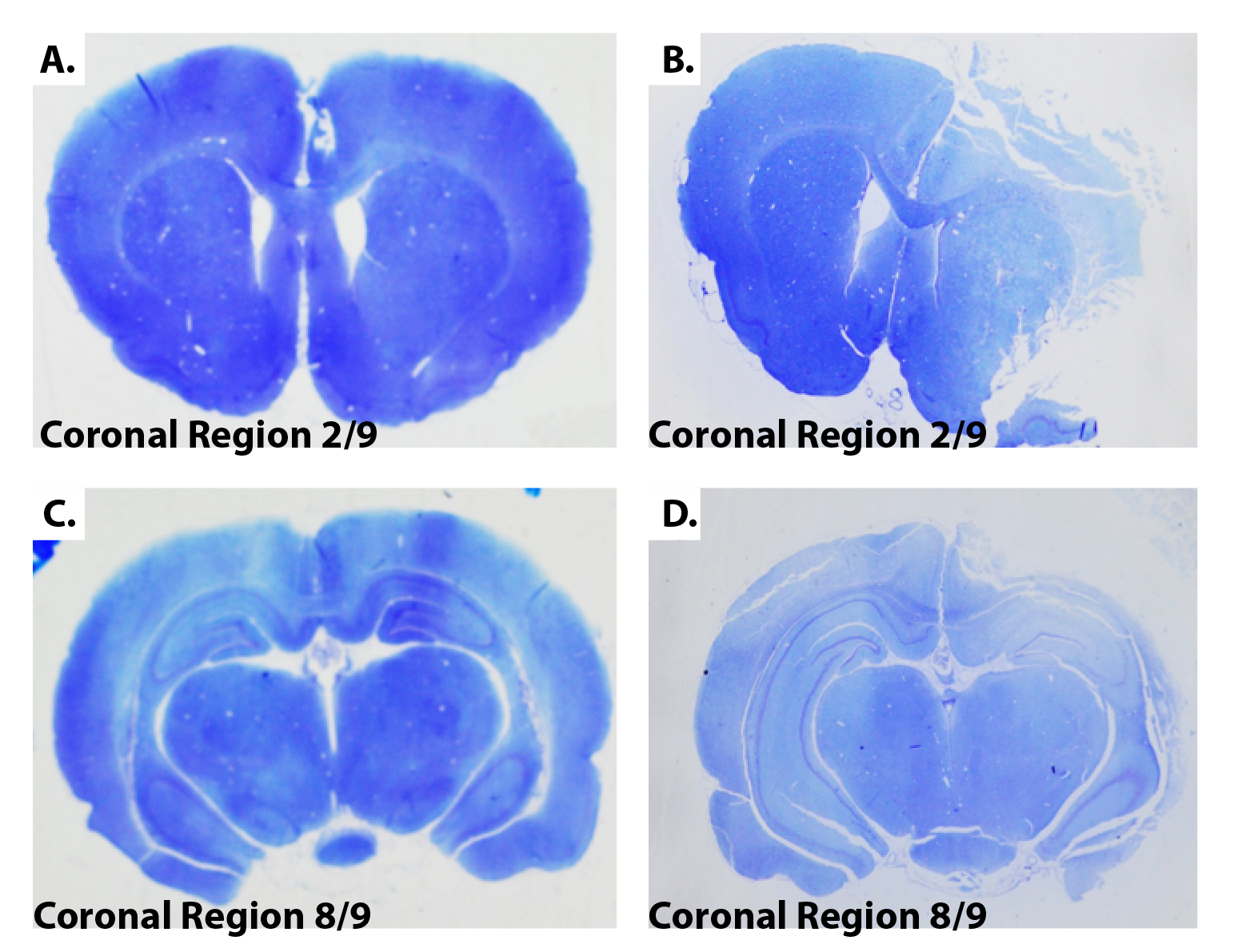 Thionine-Staining-Of-Coronal-Brain-Sections-MCAo-Model-Ischemic-Stroke
