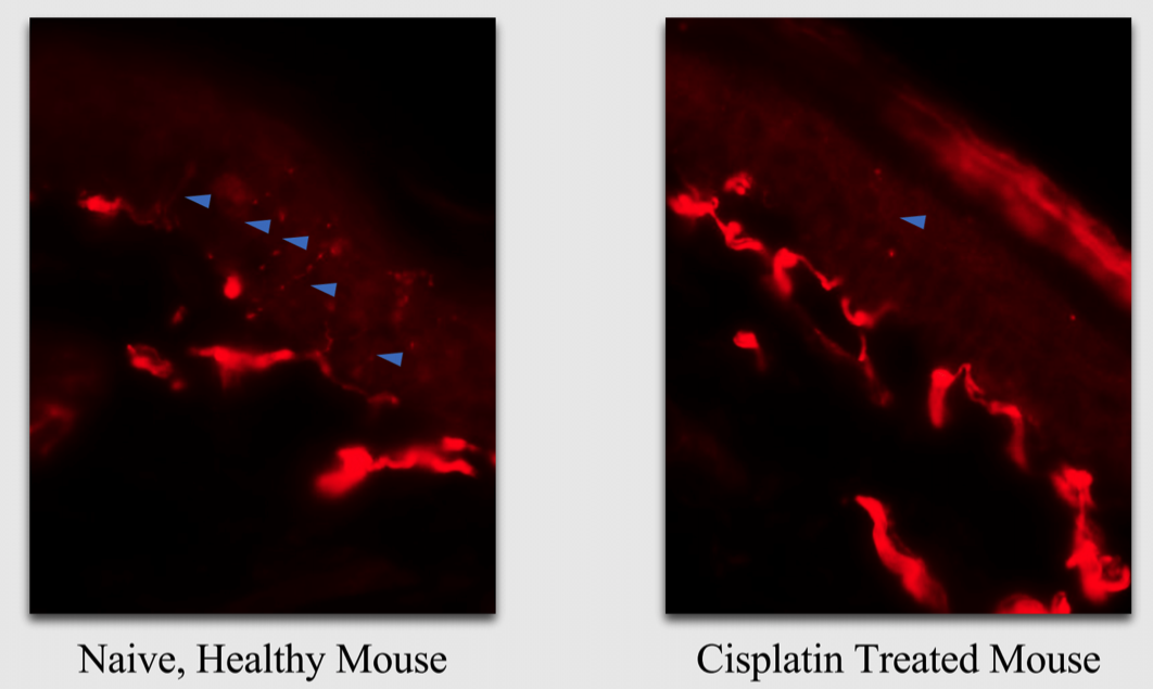IENF Cisplatin-CIPN-mdbiosciences