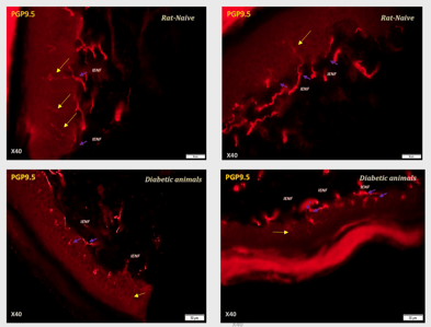 IENF staining