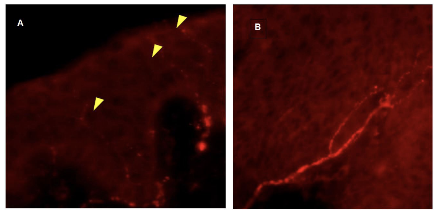 intraepidermal nerve fiber density in the translational pig model of post-operative pain by MD Biosciences, a preclinical CRO specialized in neuroscience, CNS, and pain models