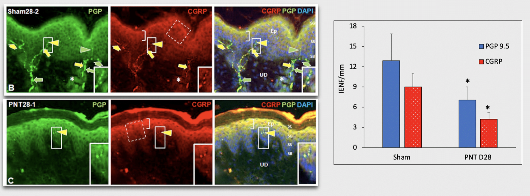 PNT sciatic nerve injury pig skin biomarker