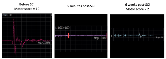 SCI EP2