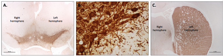 STAINING-6OHDA-SUBSTANTIA-NIGRA-MDBIOSCIENCES