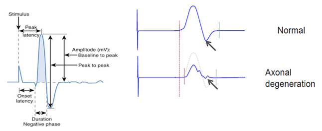 Electrophysiology