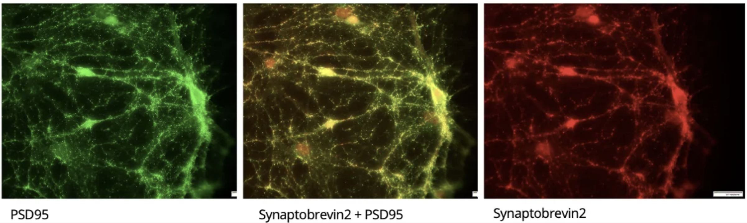 Synaptic Imaging