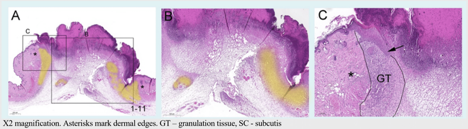 Wound healing histology md biosciences