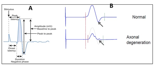 electrophysiology-capabilities-CRO