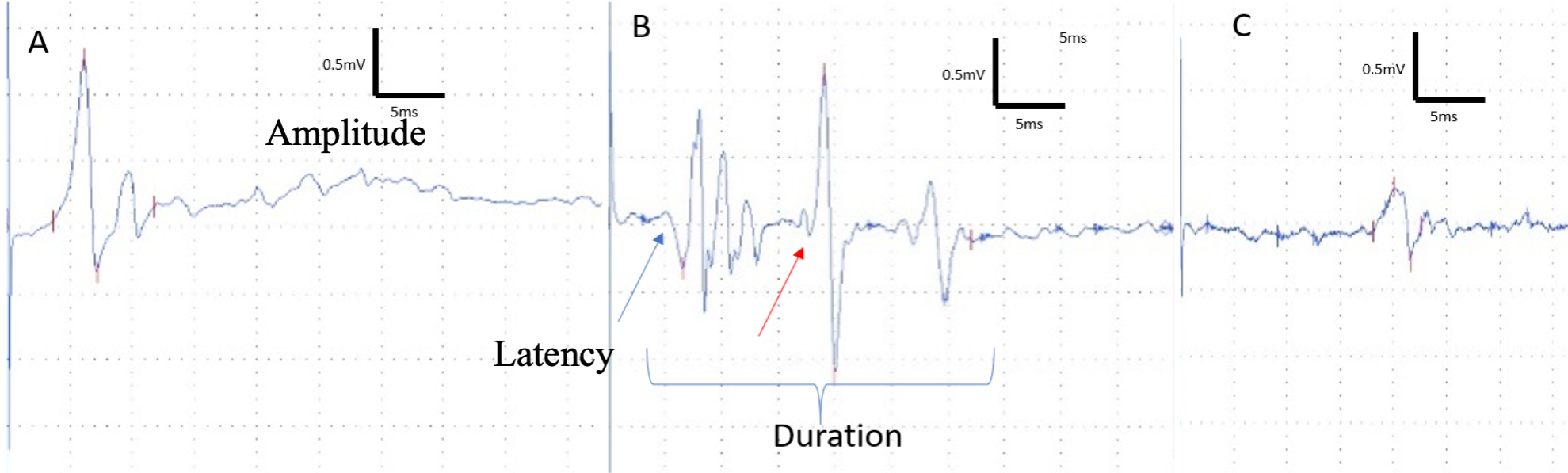 electropysiology recording