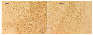 acuteMPTP-histology-MDB300px