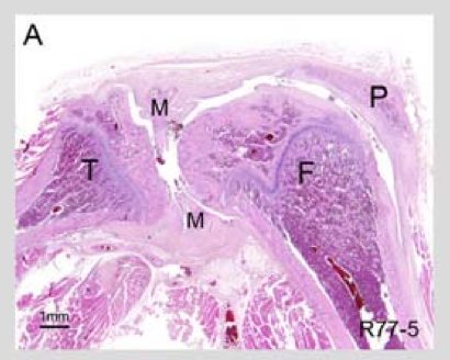 MIA_histology