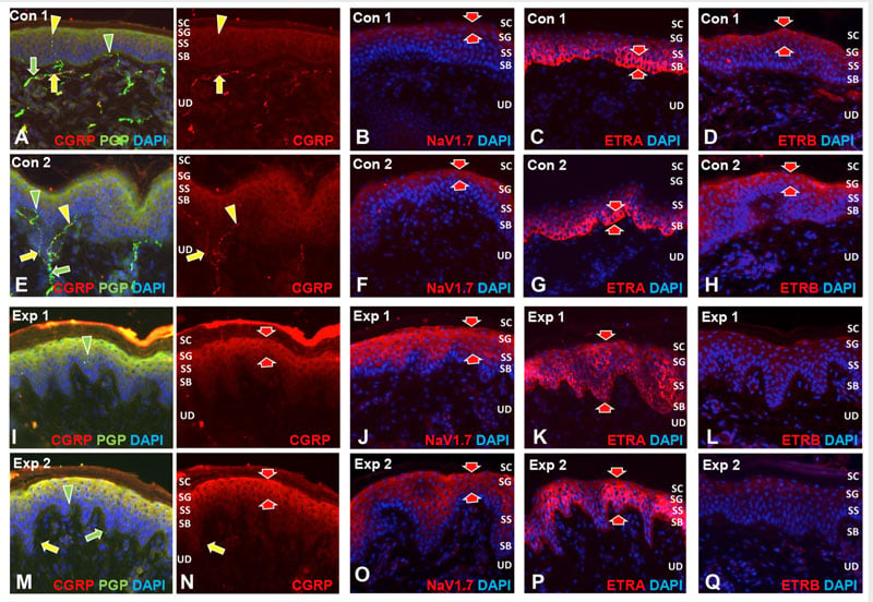 intraepidermal-nerve-fiber-staining